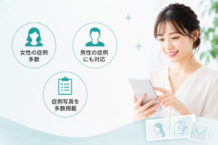 乳頭縮小術の多数の症例を閲覧する女性