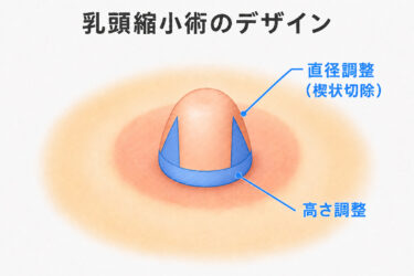 乳頭縮小手術のデザイン