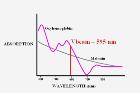 Vビームの波長と吸光度