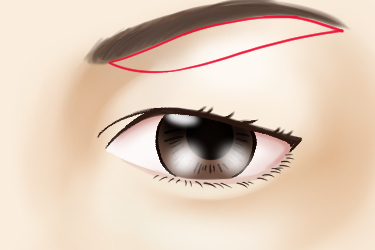 眉毛下切開法のデザイン（平行四辺形）