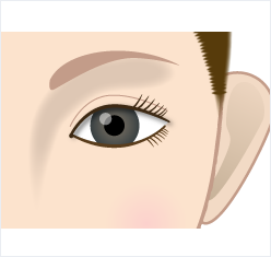 眼瞼挙筋前転法術中の開瞼状態の確認