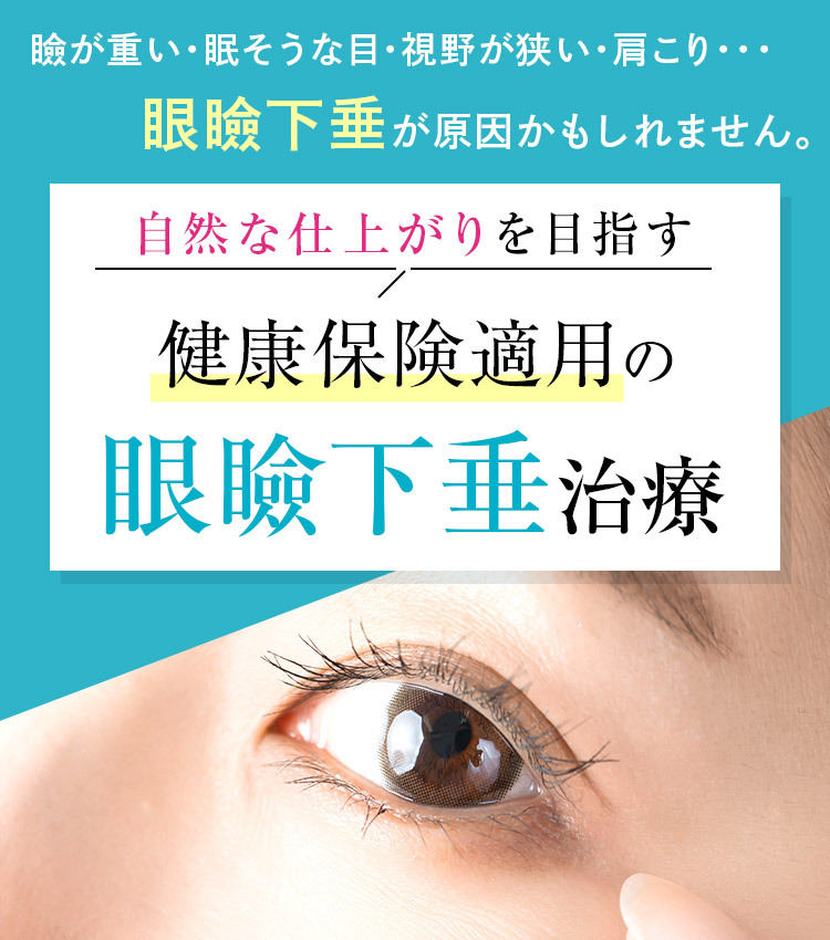 眼瞼下垂手術（保険適用）は名古屋【エースクリニック】