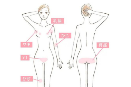 ピンクインティメイト適用部位：Vライン、Iライン、臀部、乳輪・乳頭、ワキ、ひじ、ひざ