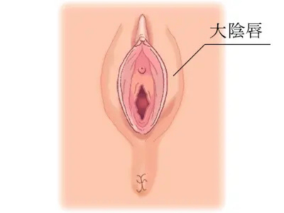 大陰唇ハイブリット