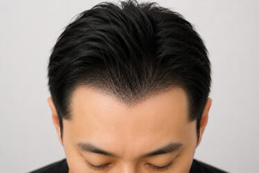 ヘアライン