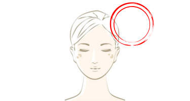 老人性色素斑