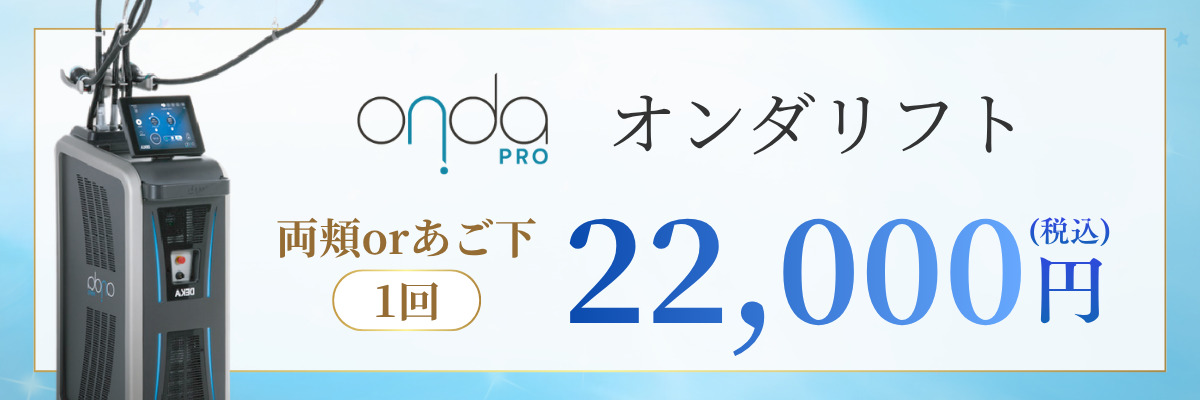 オンダリフト料金バナー