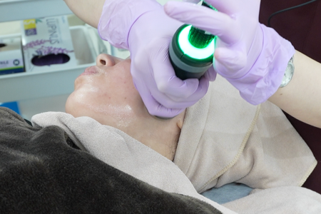 オンダリフト施術