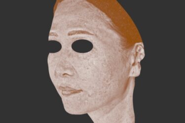 AURAによるシミ解析