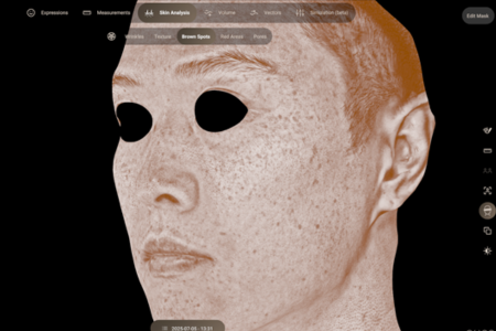 AURAによるシミ解析