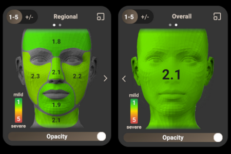 AURAによる肌解析（点数）