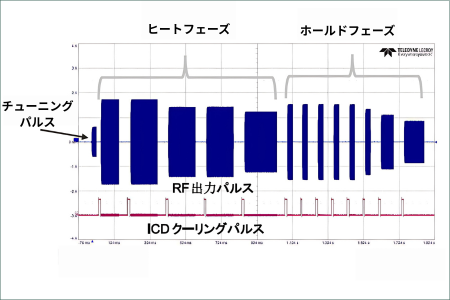 Wave Fit PulseとICD