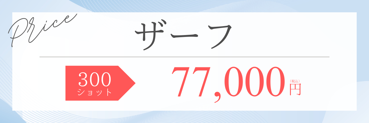 ザーフ料金バナー