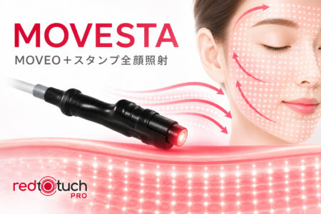 MOVESTA照射