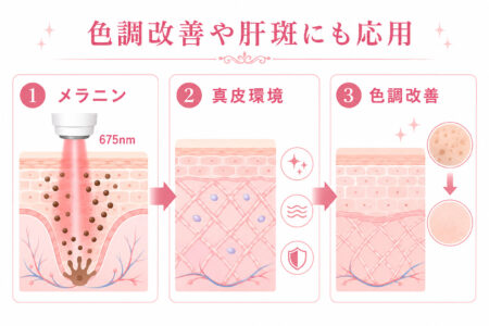 レッドタッチプロは色調改善にも有効