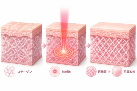レッドタッチプロはコラーゲンの再構築を促す