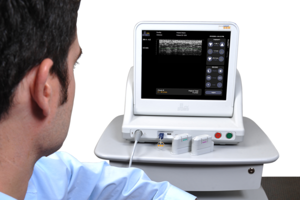 超音波画像診断装置
