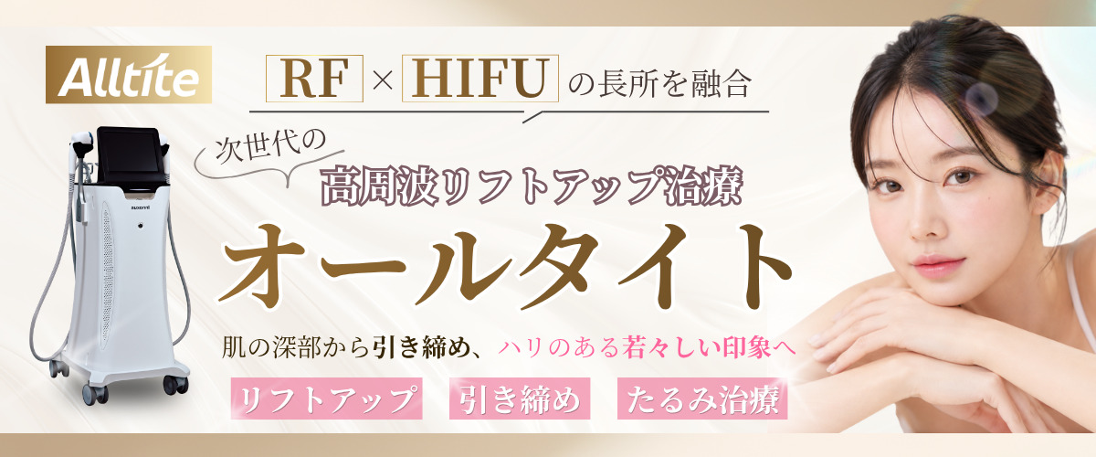 オールタイトバナー